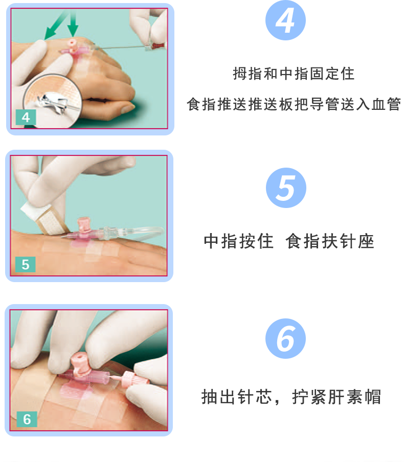 沃素安20G動靜脈留置針